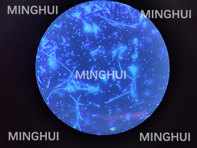 顯微鏡熒光模塊應用于真菌檢測案例-廣州明慧