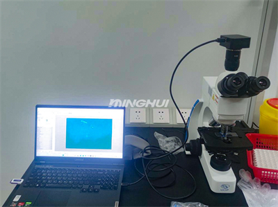 真菌熒光顯微鏡系統(tǒng)UB203i-FL和MHD600助力湖南某醫(yī)院真菌檢測 真菌熒光顯微鏡系統(tǒng)UB203i-FL和MHD600助力湖南某醫(yī)院真菌檢測