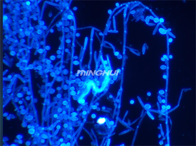 明慧UB203i-FL真菌熒光顯微鏡+MHD600顯微相機實拍效果圖3