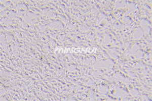細(xì)胞工廠顯微鏡MH-3CF應(yīng)用于細(xì)胞觀察